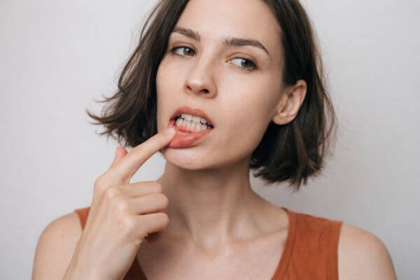 cura gengivite correzzola