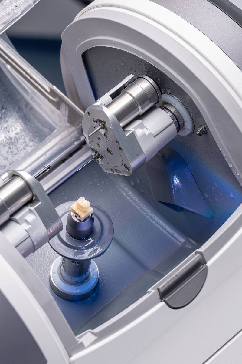 protesi mobile con cad cam dental center correzzola